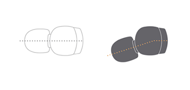 通常の形状（左）とアングルドイヤーピース方式（右）のイヤホンとの比較