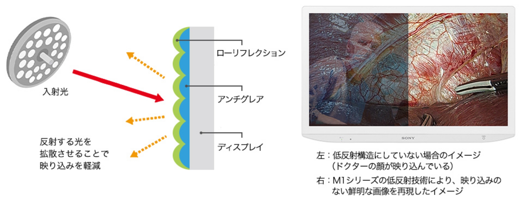 Fᔽˍ\ɂĂȂꍇ̃C[WihN^[̊炪f荞łjEFM1V[Y̒ᔽˋZpɂAf荞݂̂ȂNȉ摜ČC[W