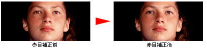 赤目補正